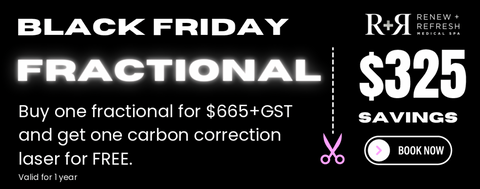Buy 1 Fractional Laser Treatment Get a FREE Carbon Correction Laser Peel