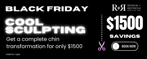 Black Friday Cool Sculpting - Chin Transformation for only $1500
